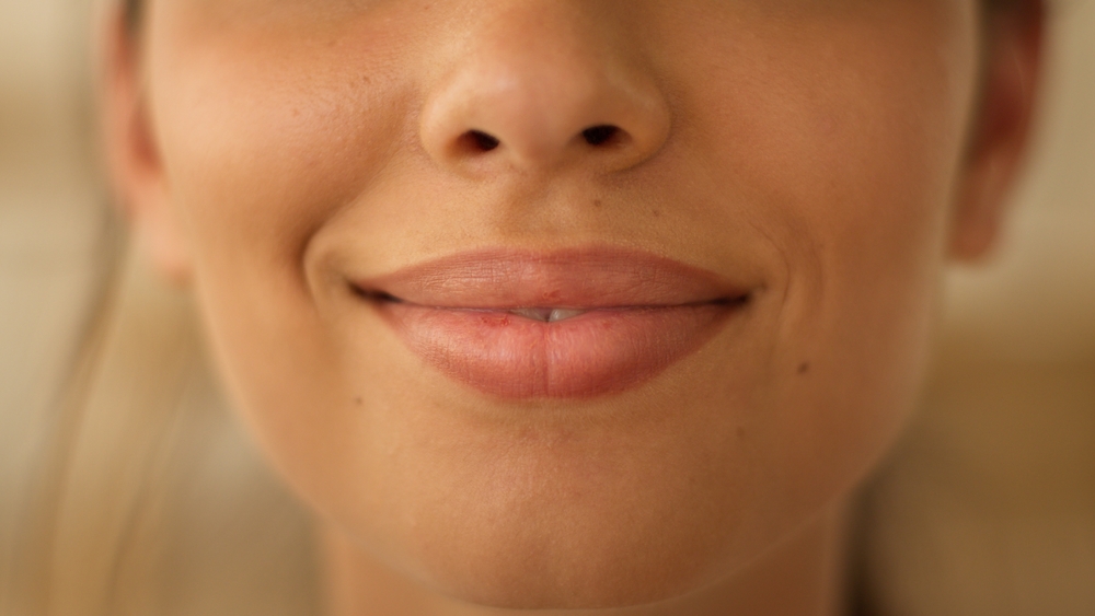 Metal Braces | Clear Ceramic Braces | Orthodontist in Melbourne | Smile Anxiety | Boosting Self-Confidence with Orthodontic Treatments
