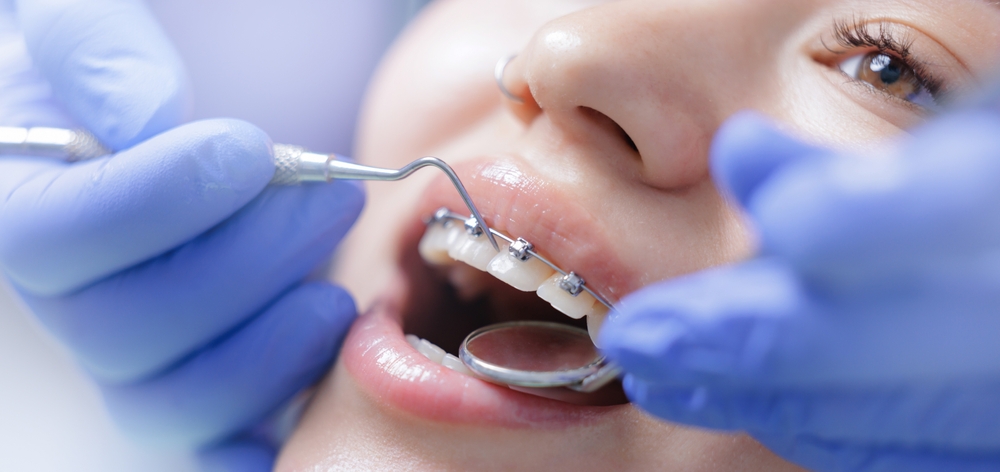 Common Orthodontic Myths & Misconceptions Explained | Orthodontic Treatments for Adults & Childrens Orthodontist | Affordable Orthodontics