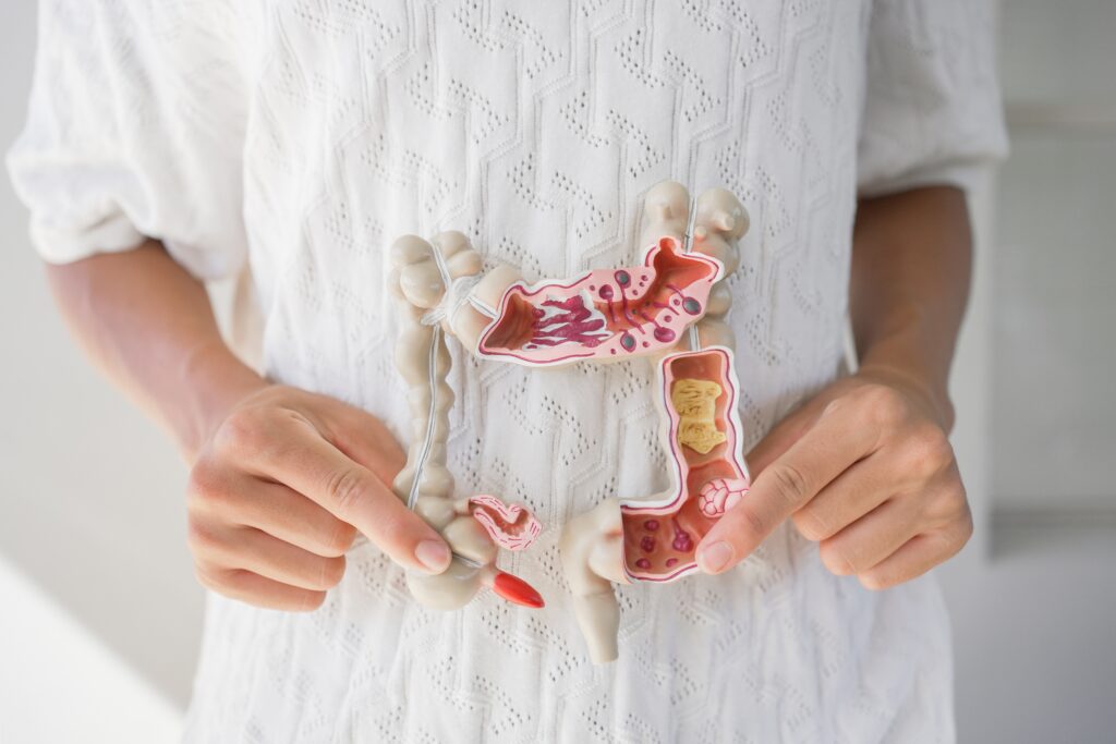 University Of Melbourne Bowel Cancer Breakthrough | Colon Cancer Rises In Victoria | Gut Bacteria | Colonoscopy in Melbourne | Colorectal Surgeon In Melbourne