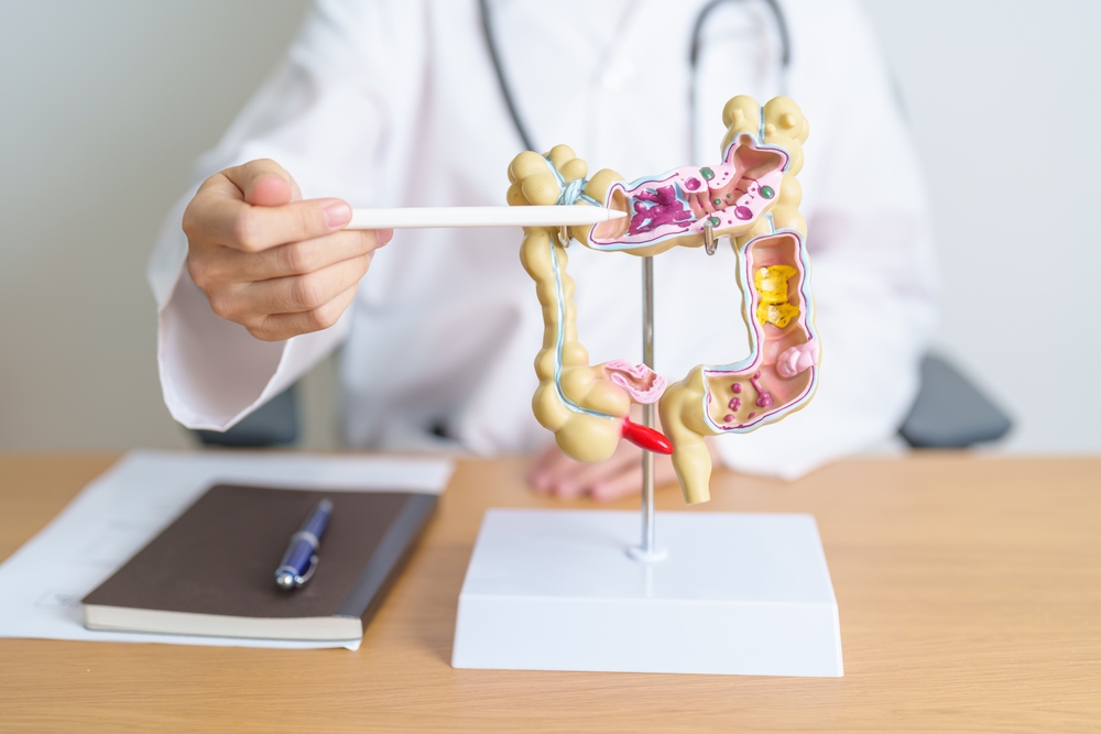 Diverticulitis Emergency Signs | When To Get Urgent Care | Colorectal Surgeon In Melbourne | Minimally Invasive Colorectal Surgery