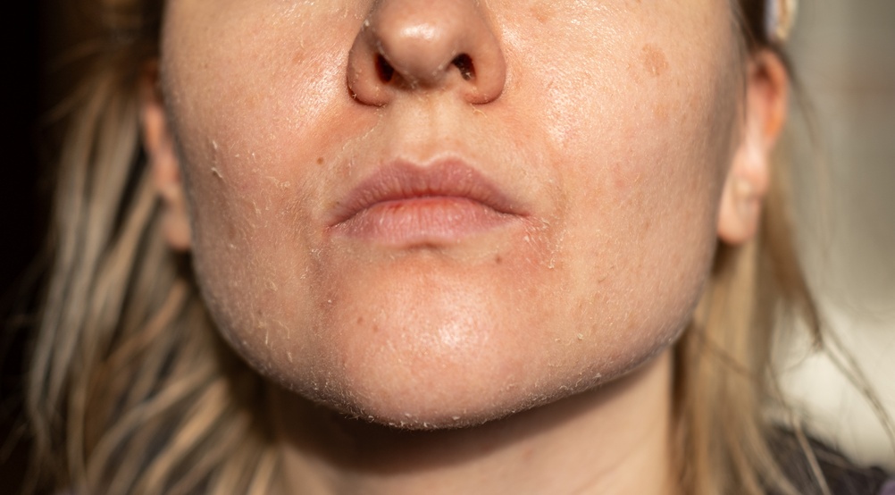 Australian skincare products featuring active skincare ingredients, including the best face cleanser, to help tackle dark spots and uneven skin tone.