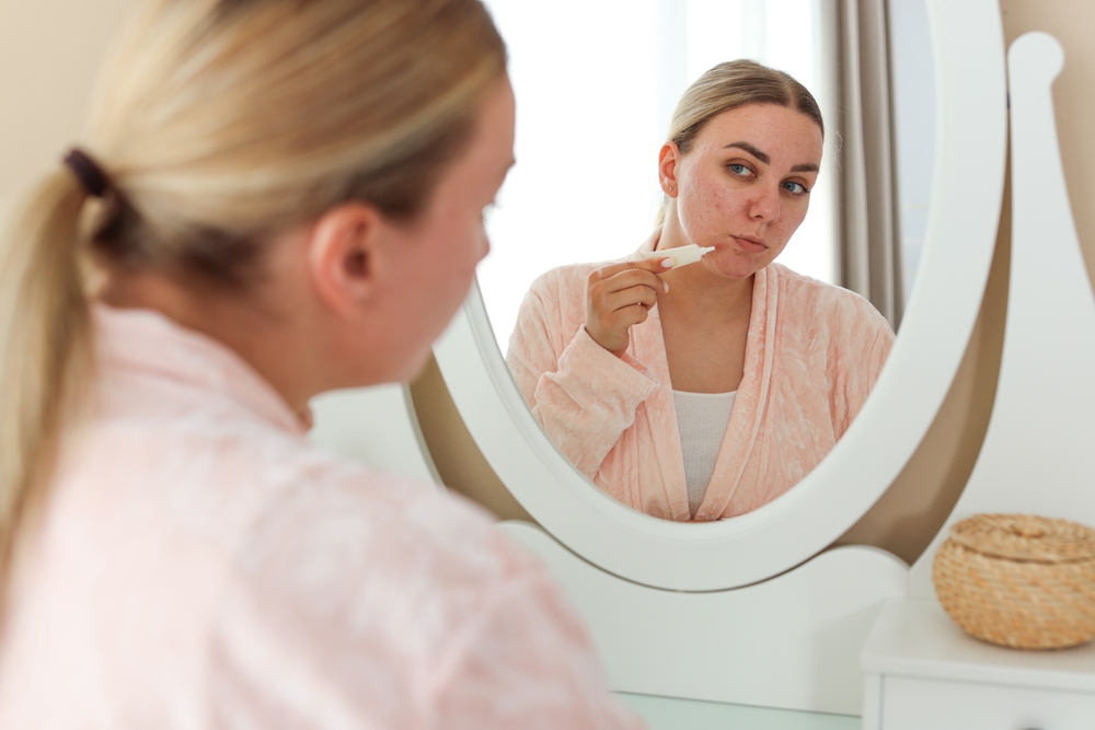 How Skin Is Affected By Hormonal Changes | Acne, Melasma & Ageing Skin | Buy RoC Skincare In Australia | Hyaluronic Acid Serum | Best Retinol Products